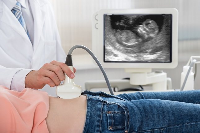 Muchas mujeres con altos niveles de andrógenos no ovulan