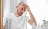 3 consejos para evitar que se te caiga el pelo